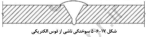 سوختگی ناشی از قوس الکتریکی